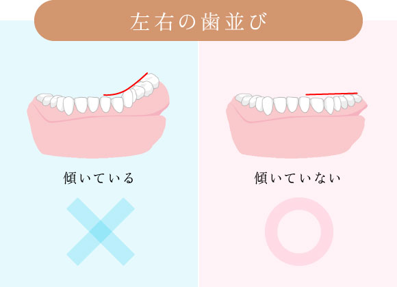 左右の歯並び